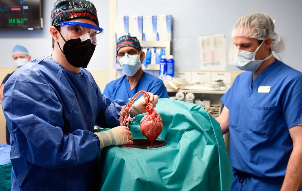 Trasplantament cor porc