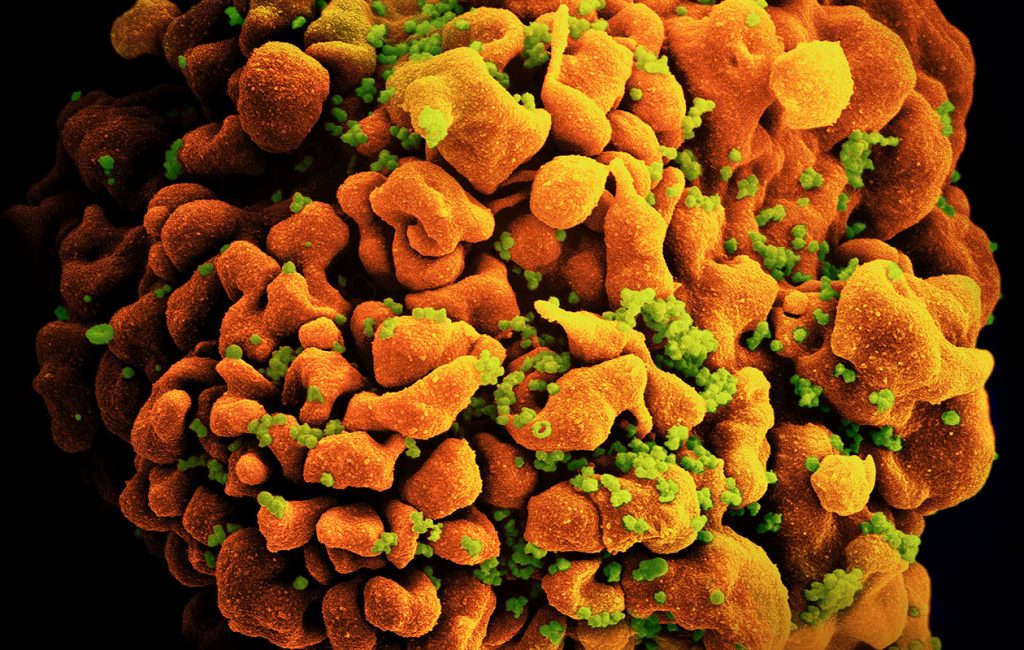 Cel·lula infectada VIH