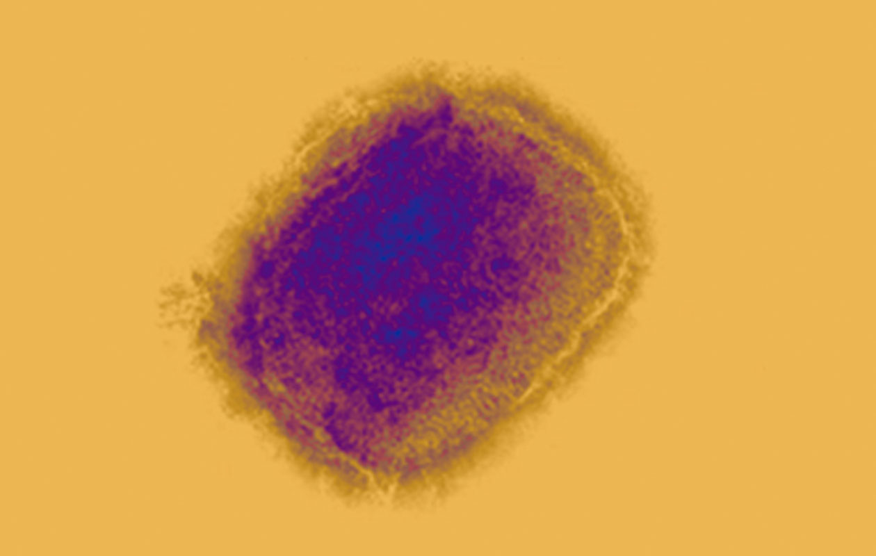 Virus verola mico